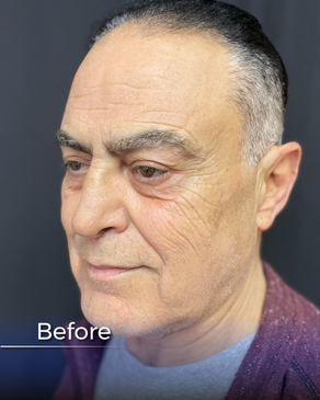 Slider image (6) Boroyan Plastic Surgery in Yerevan Armenia